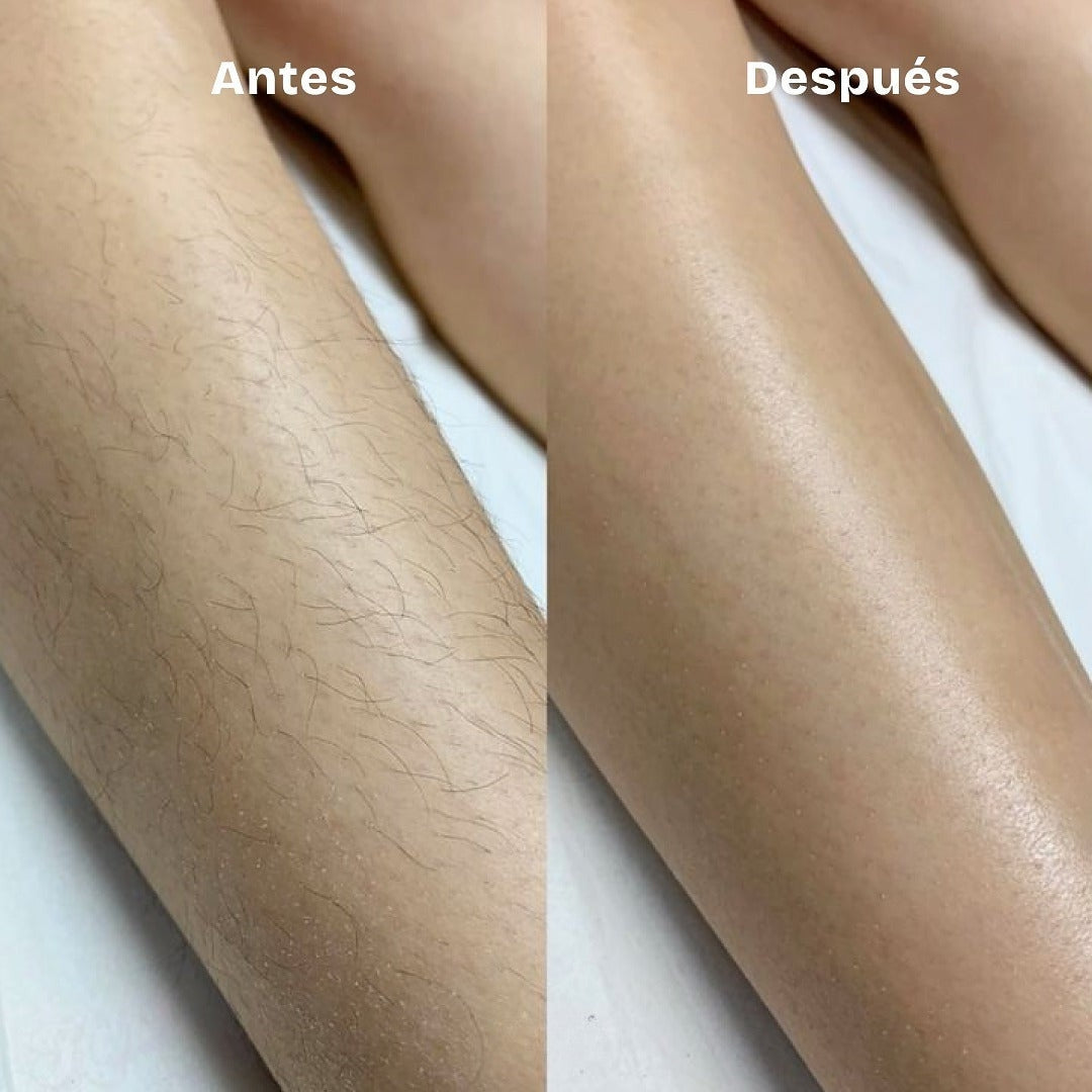 Depiladora Corporal + Facial de REGALO │ El secreto de una piel impecable