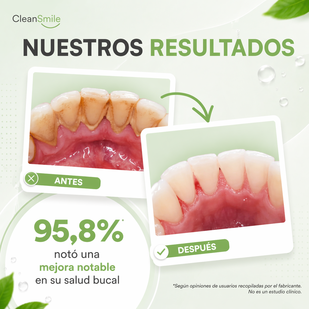 Irrigador Bucal Limpieza Profunda ┃CleanSmile™